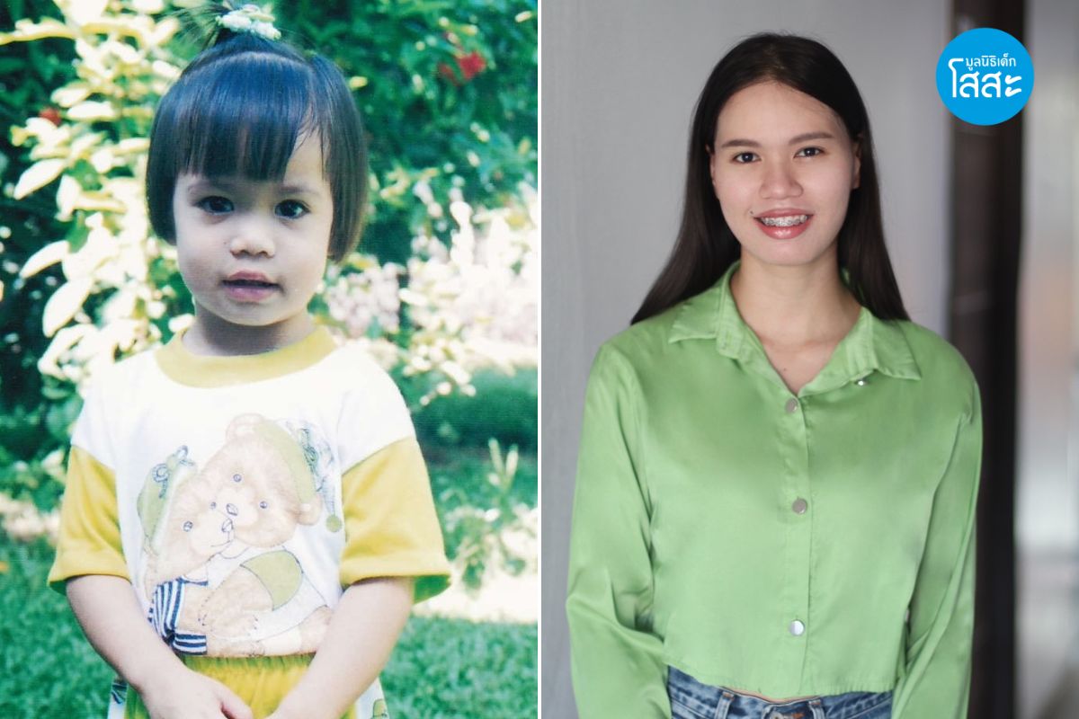 ความสำเร็จลูกโสสะ - น้องแป้ง ในวัยเด็ก และเติบโตขึ้น